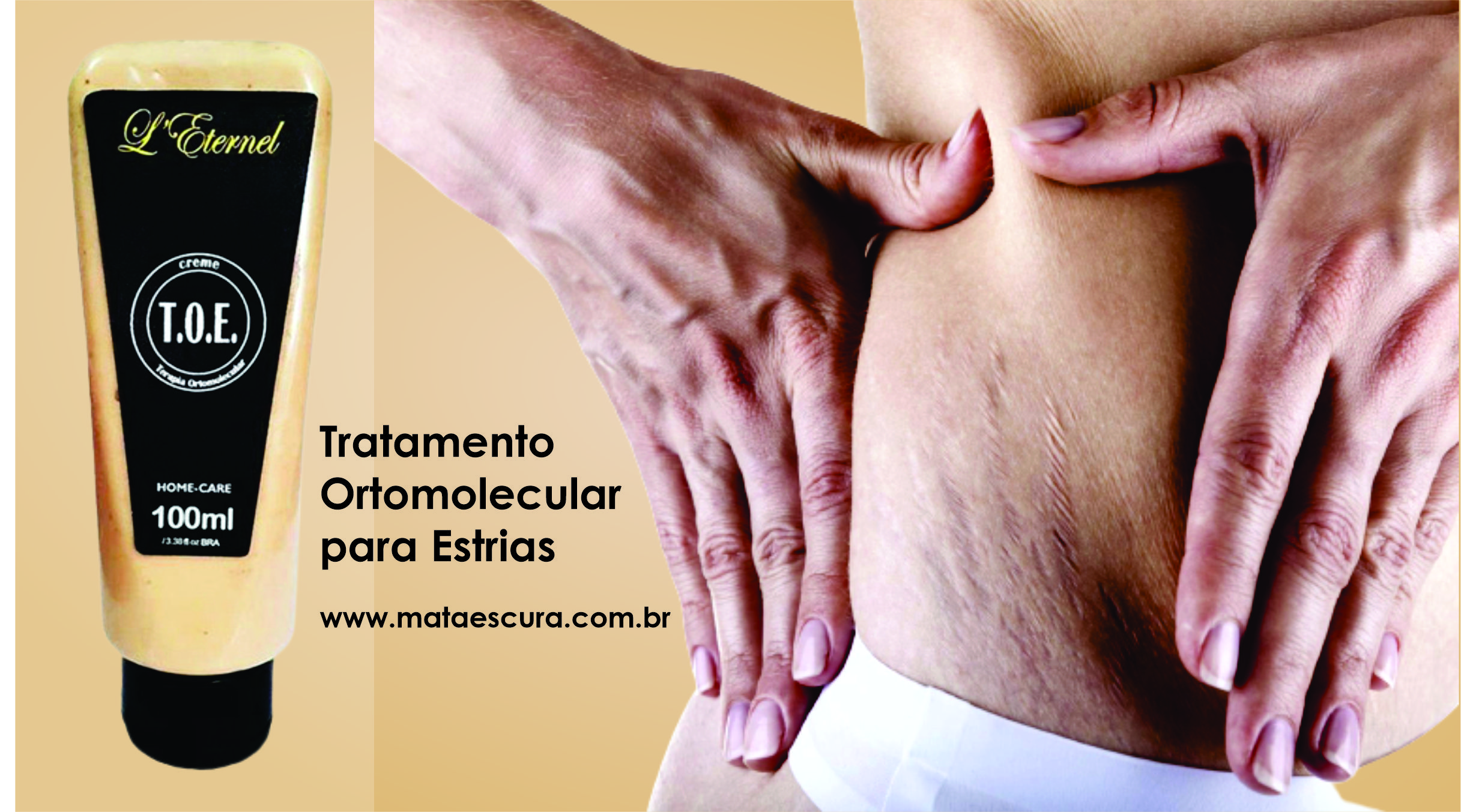 Creme para Estrias TOE